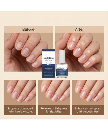 Soin fortifiant brillant pour les ongles Huile hydratante ongles Brillance hydratante quotidienne nails Soin fortifiant nails Huile r paratrice absorption rapide clavos secs cassants (6pcs) - Buy Online on GoSupps.com