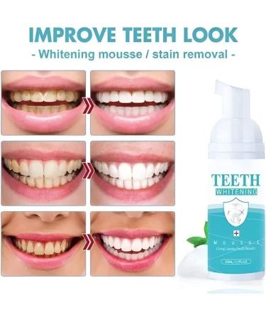 50ml Saveuppro Teeth Whitening Mousse Foam for Fresh Breath & Deep Cleaning - Travel Friendly & Easy to Use - Buy Online on GoSupps.com
