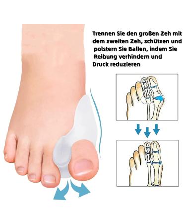Buy 4X Silicone Hallux Valgus Toe Correction Splint | Toe Spreader & Ball Protection for Pain Relief - Buy Online on GoSupps.com