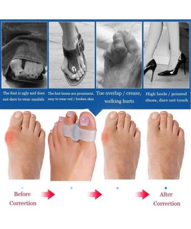 Buy 10 Pieces Bunion Corrector & Silicone Toe Separators - Big Toe Spacer for Overlapping Toes | International Shipping Available - Buy Online on GoSupps.com