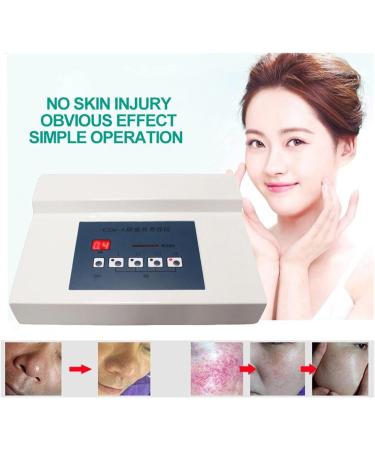 Generous Spider Vein Removal Device | High-Frequency Facial & Leg Treatment | Home Salon Beauty Equipment - Buy Online on GoSupps.com