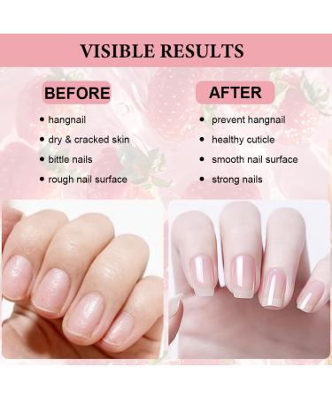 LOPHE Huile pour Cuticules et Ongles 15 ml - Renforce et Adoucit Ongles/Cuticules - Soin Quotidien & Post-Manucure - Pour Mains Douces et Ongles Brillants- Mangue/Ananas/Fraise 3pcs - Trio Tropical - Buy Online on GoSupps.com