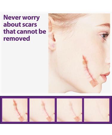 Actsyl-3 Silicone Scar Removal Sheets - Professional Grade for Surgery, Burns, Keloids & Stretch Marks - Reusable for Old & New Scars - 4 Sheets for Glowing Skin Care - One Size - Buy Online on GoSupps.com