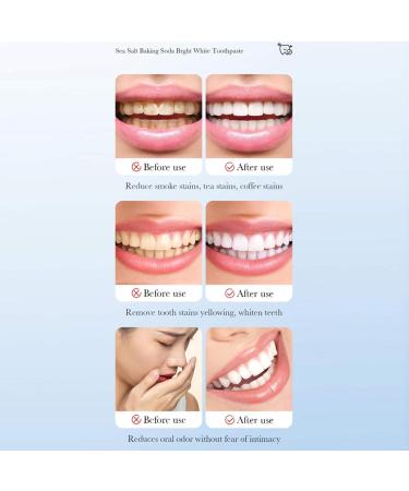 3-Count Refreshing Mint Toothpaste Set Deep Clean Action for Fresh Breath and Stain Management Sea Salt One Size One Size Sea Salt - Buy Online on GoSupps.com