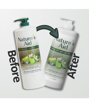 Nature's Aid Original Skin Gel with Aloe Vera - Soothes Dry Itchy Skin Acne Sunburn & Rashes | Global Shipping Available - Buy Online on GoSupps.com