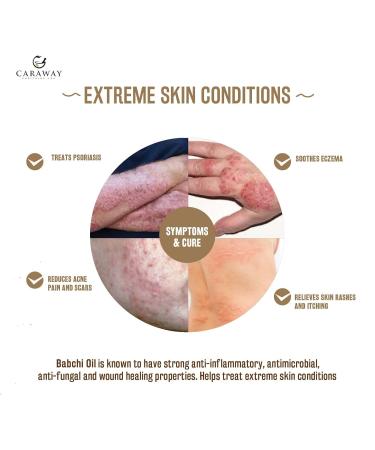 CARAWAY BAKUCHI OIL - Supercritical CO2 Extract| Pure Babchi Oil for Skin Pigmentation Vitiligo & Uneven skin tone| Bakuchi Seed Oil 50ml - Buy Online on GoSupps.com