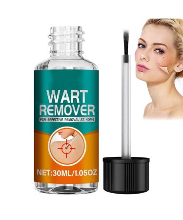 30ml Skin Remover Fast-Acting Skin Remover for Hands and Body Fall Away Quickly Natural & Safe Remover