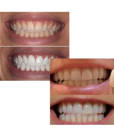 SowSmile Dental Teeth Whitening Serum - 48.0g: Oral Hygiene Whitener for Plaque Stains & Fresh Breath - Buy Online on GoSupps.com