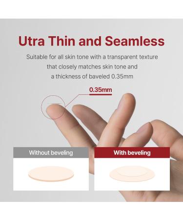 Trouble Cover Calming Clear Spot Patches - 100 Count Hydrocolloid Acne Treatment for Zits Pimples & Blemishes | Korean Spot Patch for Troubled Skin - Buy Online on GoSupps.com