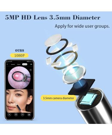 Ear Wax Removal Tool Camera 1080P Earwax Remover & Blackhead Cleaning Kit - iPhone & Android Compatible (Black) - Buy Online on GoSupps.com