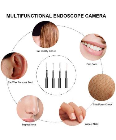 Sanon Otoscope Ear Wax Remover Camera with 6 Dimmable LED - HD Visual Camera for Adults, Kids, and Pets - Compatible with Android Tablet and PC - Buy Online on GoSupps.com