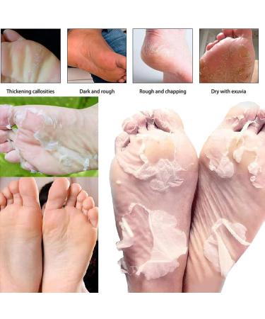 Masque exfoliant pour les pieds hydratant et blanchissant nourrit les peaux s ches et limine les callosit s. 2pcs - Buy Online on GoSupps.com