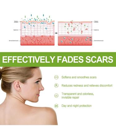 BOKIOESDE Women Hip Chest Stretch Mark Serum Body Burn Scars Serum Girls Skin Care Repair Essence Beauty Supplies - Buy Online on GoSupps.com