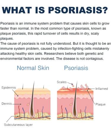 LMDO Psoriasis Relief Spray - Eczema Therapy for Itching Relief & Skin Repair - Buy Online on GoSupps.com