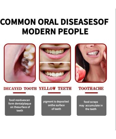 2 Pcs SP-8 Probiotic Whitening Toothpaste Triple Whitening Care Deep Cleaning Fresh Breath. - Buy Online on GoSupps.com