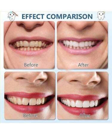 Brigtviee 2 Pairs Instant Veneers Dentures ClipIn Veneers Top and Bottom of Teeth ClickOn Veneers Teeth Fake Teeth False Teeth Whitening Veneers for Covering Imperfect Teeth - Buy Online on GoSupps.com