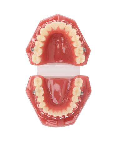 Orthodontic Demonstration Model for Dental Research | Metal Wires & Ceramic Brackets | Teaching Aids for Adults - Buy Internationally - Buy Online on GoSupps.com