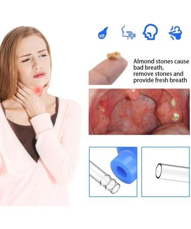 Best Tonsil Stone Remover Tool - Remove Almond Stones with Cupping Glass & Cleaning Brush for Oral Care | XPJBKC - Buy Online on GoSupps.com