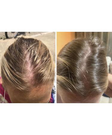 ElvenLux Ginger Hair & Scalp Elixir | Strengthen & Nourish Hair | International Shipping Available - Buy Online on GoSupps.com