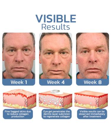 Nordizoe Openeyes Awaken Peptide Lifting Eye Gel - Anti-Wrinkle & Firming Men's Eye Cream (5Pcs) - Buy Online on GoSupps.com