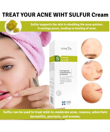 TIS Pharmaceutical TIS Sulfur 7 Cream For Oily Acne Seborrheic Skin Care Removes Skin Seborrheic Flakes Exfoliating Properties Face and Body Unisex - Buy Online on GoSupps.com