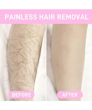 2022 New Crystal Hair Eraser: Portable Hair Remover for Women and Men - Painless Skin Exfoliator Tool in Black+Blue - Buy Online on GoSupps.com