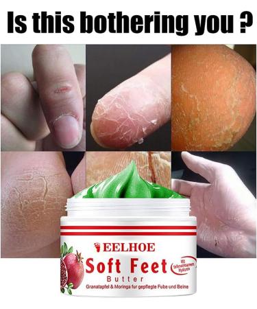 Frost Protection Cream for Feet | Anti-Crack Moisturizer & Dead Skin Foot Butter | Nourish & Repair with Effective Foot Care Cream - Buy Online on GoSupps.com