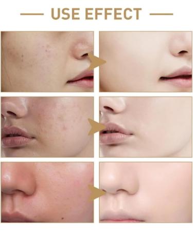  Yanobia Charwee Brown Spot Concealer for Face Brown Spot Corrector Cream Charwee Face Cream Quick Tone Repair Reveals a Radiant Complexion You Love (2 Pieces 1) - Buy Online on GoSupps.com