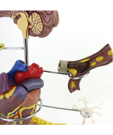 Diabetes Model Set Diabetes ICal Model Human Organ Coronary Artery Thrombosis Model Arteriosclerosis in Vitro - Buy Online on GoSupps.com
