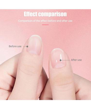 Strengthening Nail Growth Oil Nourishing Oil for Thin Nails Nail Cuticle Oil Protective Oil Moisturizing Nourishing Nail Strengthening - Buy Online on GoSupps.com