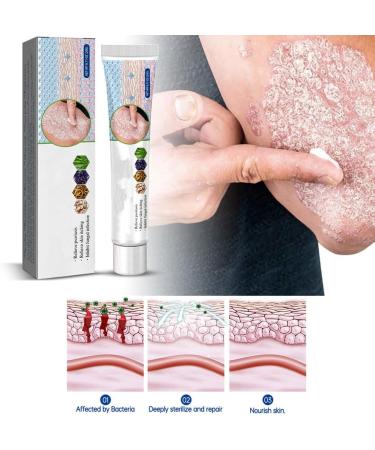 Face Cream Body Cream Anti-Itch Cream Chinese Herbal Cream Skin Repairing Cream for Face Body Cream for Itchy Skin Moisturizing Skin Cream 20 g - Buy Online on GoSupps.com
