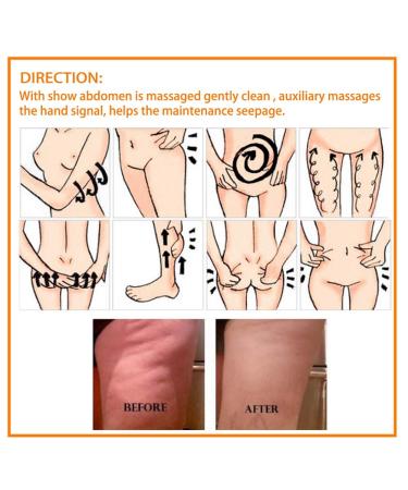 Fat Burner Slimming Cream - Abdominal Reducing & Cellulite Hot Massage Cream for Weight Loss - 250g - Buy Online on GoSupps.com