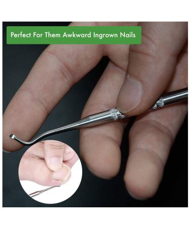 Skinapeel Toe Nail Softener & Ingrown Toenail Treatment Oil with Corrector Tool - Buy Online on GoSupps.com