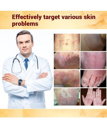 Amzfly Oversea Thousand-Year Herbal Cream Chinese Herbal Eczema Psoriasis Creams Dermatitis and Eczema Pruritus Psoriasis JIULIN Ointment (2PCS) - Buy Online on GoSupps.com