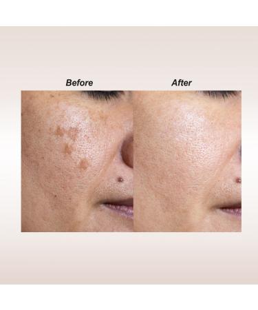 Dalfour Beauty Dark Creamy + Gold Seal Lightening Cream Red M - Crystallide Formula - Buy Online on GoSupps.com