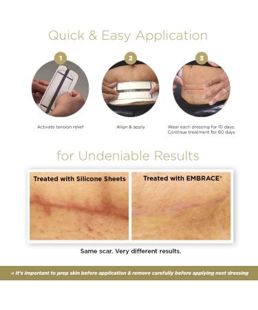Embrace Scar Treatment - Extra Large Silicone Sheets (6.3in) for New Scars | 60 Day Supply - Buy Online on GoSupps.com