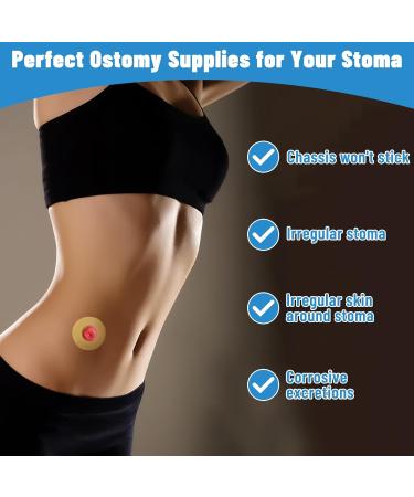 Ostomy Barrier Rings - Moldable Hydrocolloid Ring Supplies for Colostomy Bags | Stoma Care Solutions - Buy Online on GoSupps.com
