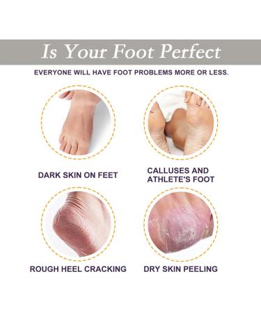 SURORAIN Advanced Foot Repair Cream - Moisturizing Hand & Body Moisturizer for Dry Cracked Heels, Callus Remover - 0.53 oz - Buy Online on GoSupps.com