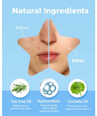 LitBear Acne Patch 6 Colors Star Shaped 168 Count - Hydrocolloid Pimple Patch with Tea Tree Oil for Face - Acne Absorbing Cover Patch - Buy Online on GoSupps.com