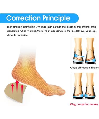 Orthopedic Silicone Gel Heel Wedge Insoles - 2 Pairs | Foot Alignment Support for O/X Leg, Bowlegs and Knock Knees - Buy Online on GoSupps.com