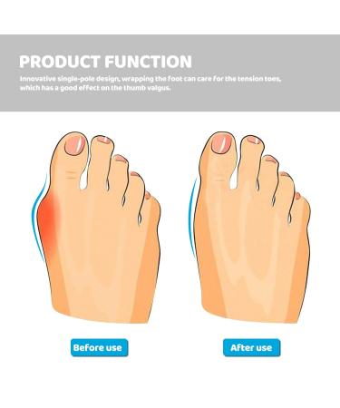 Minkissy 24-Piece Silicone Toe Spreader & Nail Art Separator - Flower Pattern Toe Protection & Divider for Women | Perfect for Pedicure & Manicure - Buy Online on GoSupps.com