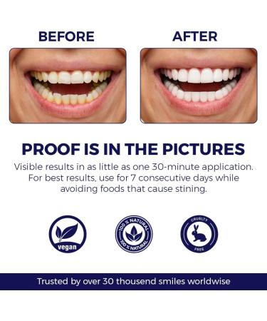 DENTELO Teeth Whitening Strips |Zero Sensitivity |Non-Slip Grip |Dentist Formulated Teeth Whitening Kits UK Teeth Whitener Strips Tooth Whitening Strip Teeth Whiteners whitestrips 1 count (Pack of 28) - Buy Online on GoSupps.com