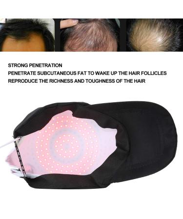 RegrowMD Laser Hair Growth Cap - Advanced Hair Loss Treatment for Men & Women | 108 Chips for Thicker Denser Hair - Buy Online on GoSupps.com