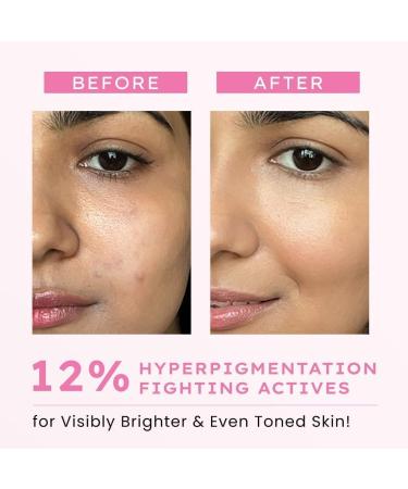 AIN Advanced De-Pigmentation Serum For Hyperpigmentation Melasma Dark Spots & Scars With 2% Kojic Acid | Visibly Brightens & Even Tones Skin | For Women & Men - 30ml - Buy Online on GoSupps.com