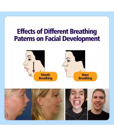 OKTAPE Adult Sleep Strips - 30 Pieces | Mouth Shape Anti-Suffocation Design | Stretchable Mouth Tape for Better Nose Breathing | Pink Adult - Buy Online on GoSupps.com