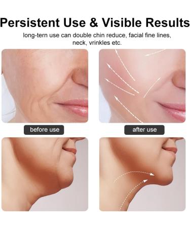 Enarit Firming Wrinkle Removal Facial Massager Tool - LED Heat Modes for Skin Tightening (White) - Buy Online on GoSupps.com