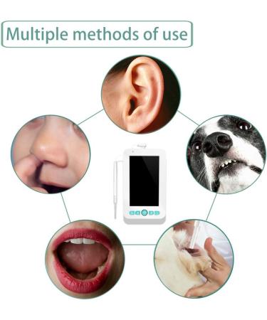 USB 4.3 inch high-Definition Visual Ear Pick with Screen Ear Cleaner Luminous ENT Visual Endoscope Compatible with iOS Android - Buy Online on GoSupps.com