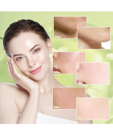 Fengyang 5-in-1 Skincare Set Tea Tree Skin Care Set Tea Skin Care Gift Set Green Tea Skin Care - Buy Online on GoSupps.com