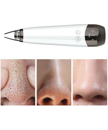 Kapmore Rechargeable USB Pore Electric Cleaner for Women and Girls Acne Tools Acne Electric Remover Portable Acne Electric Remover - Buy Online on GoSupps.com
