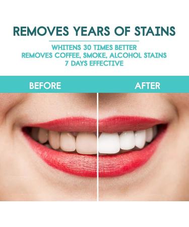 Natural Coconut Teeth Whitening Pen - Upgraded 5ml Gel, 50 Uses, for Kit, No Sensitivity - Buy Online on GoSupps.com